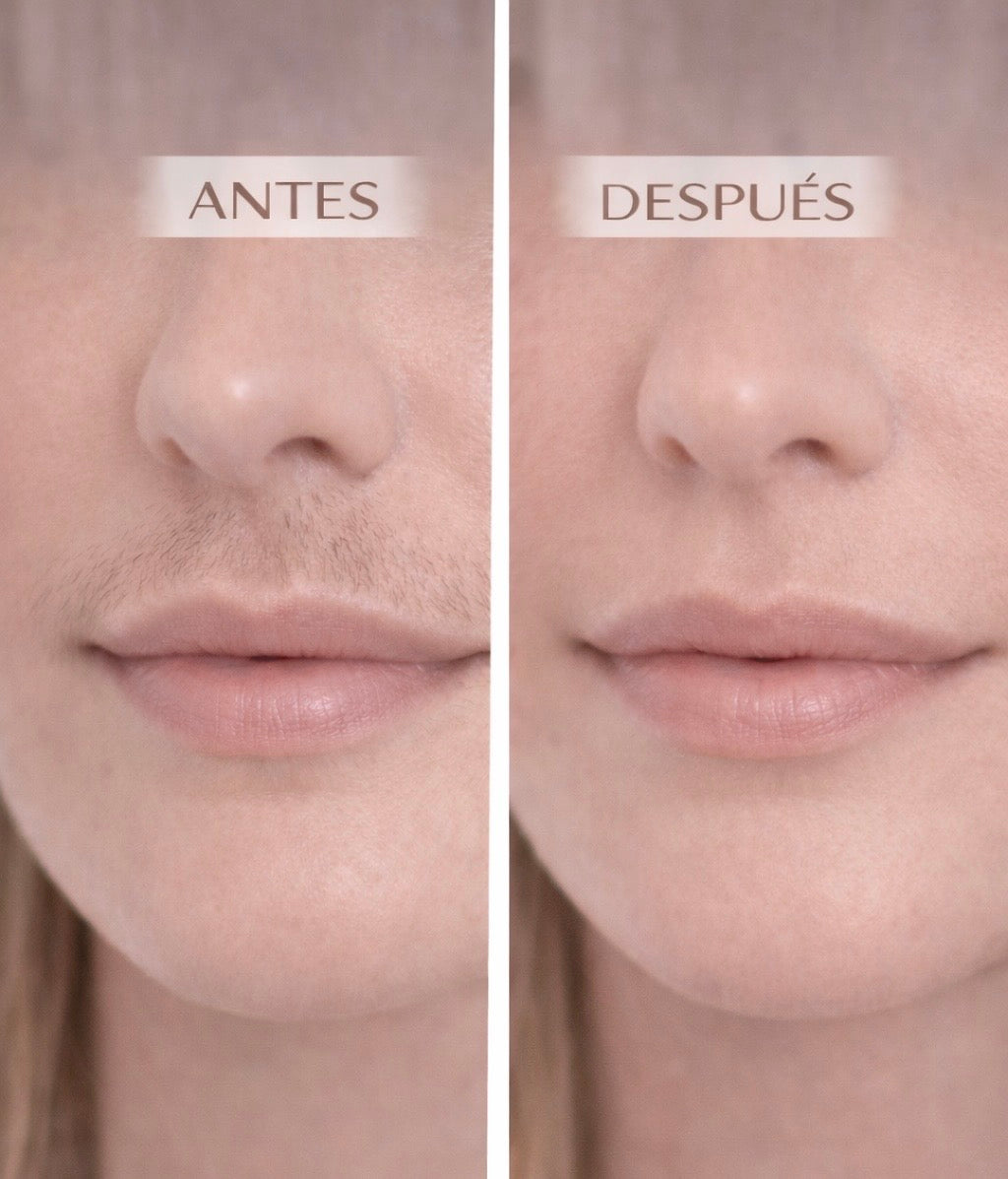 LUMYNIA™ | Depilación IPL Profesional en Casa