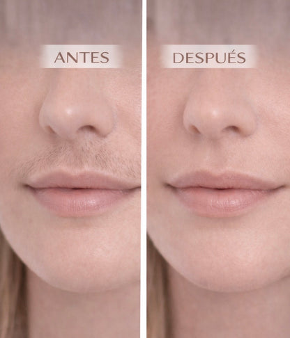 LUMYNIA™ | Depilación IPL Profesional en Casa